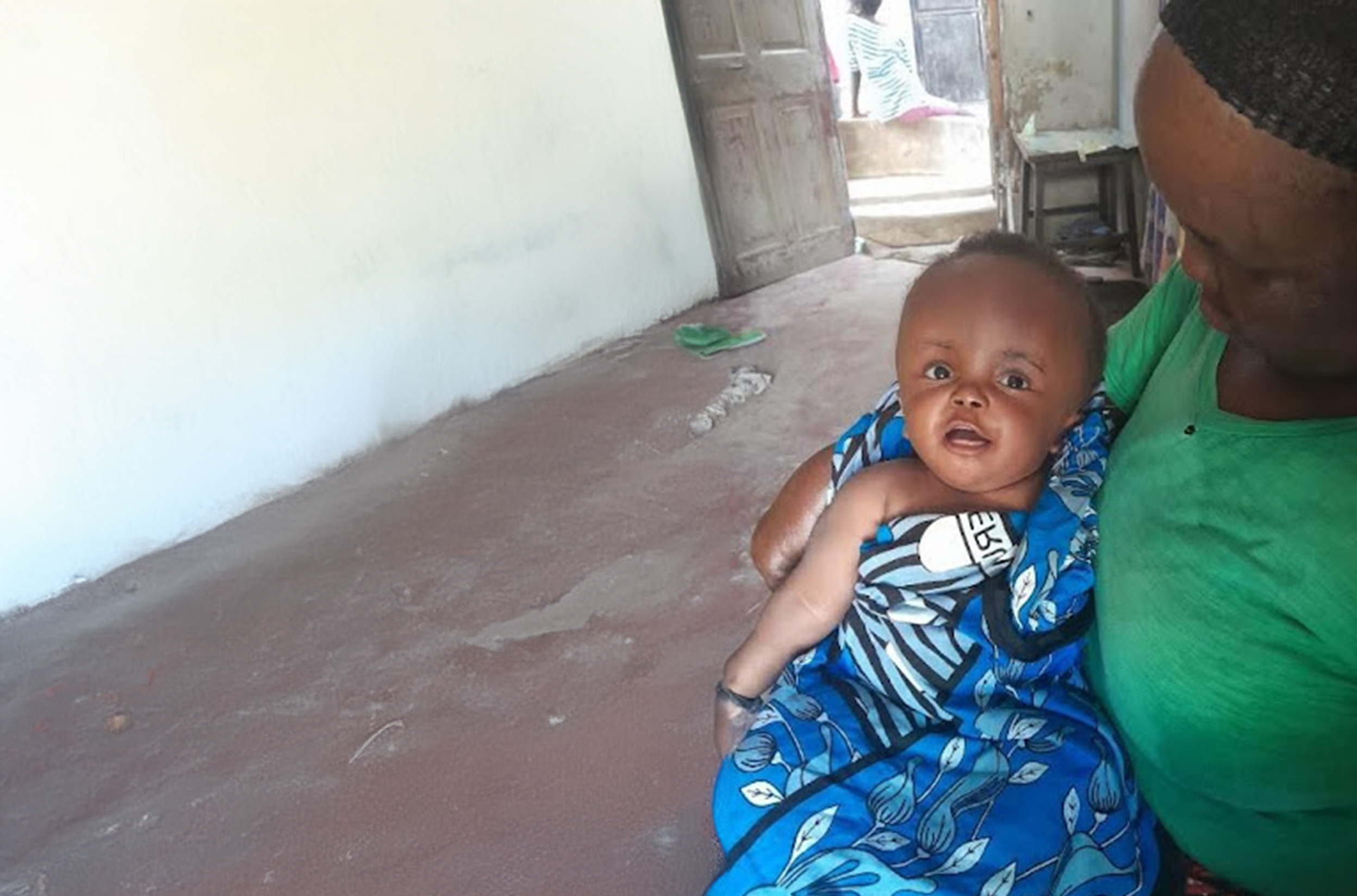 Successful hydrocephalus treatment with ETV/CPC in Mombasa, Kenya