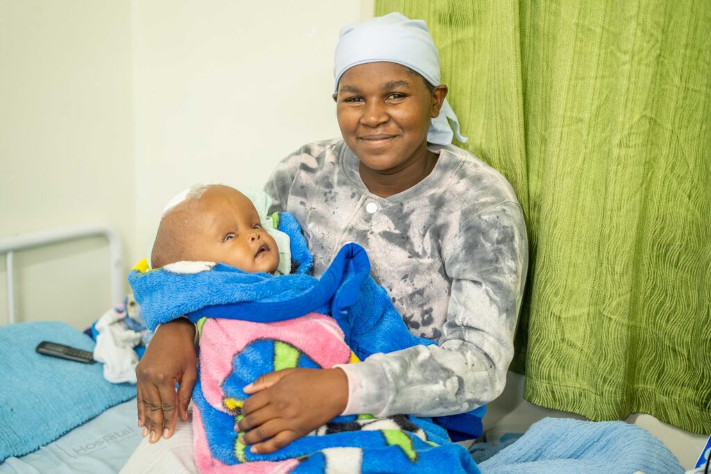A mother named Sarah, holding her child who has hydrocephalus.