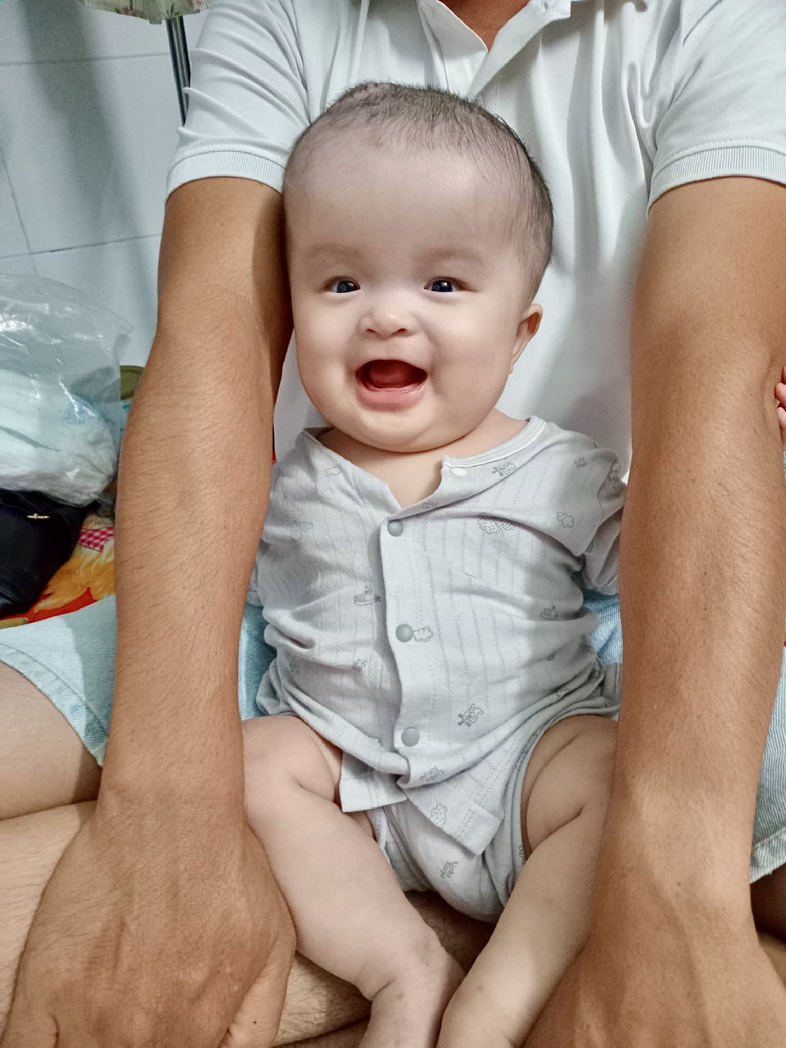 Nguyen Hoa Vietnam child with hydrocephalus